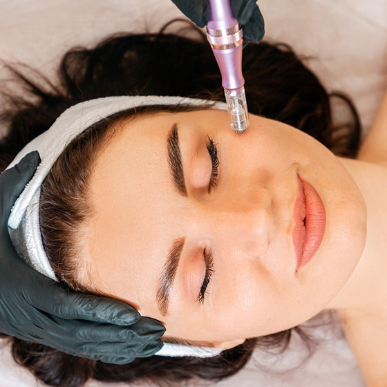 PRP-Facial PRP-Facial
