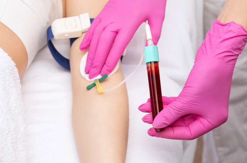 Patient’s-blood-being-drawn-for-24KT-Hydraneedle-PRP-treatment