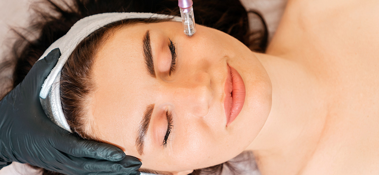 Woman-undergoing-microneedling-during-PRP-facial