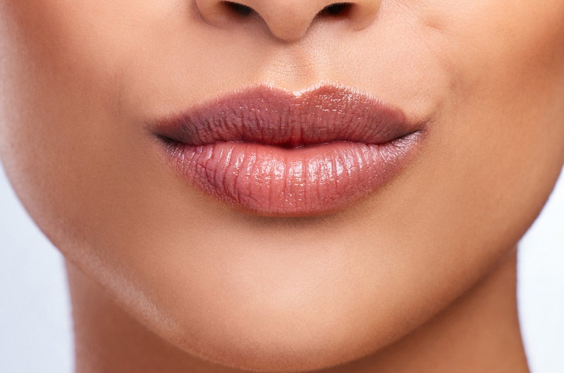 Woman-puckering-her-lips-with-Revanesse-Versa+-filler