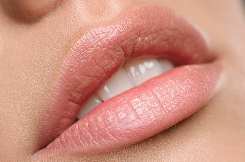 Woman-with-full-lips-after-Revanesse-Lips-injection